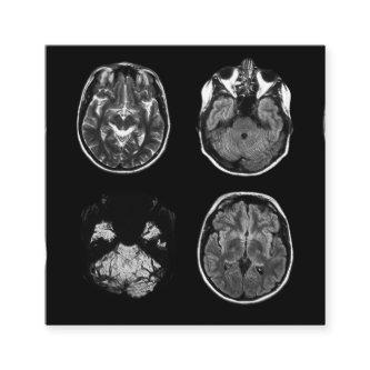 Brain MRI scan Square
