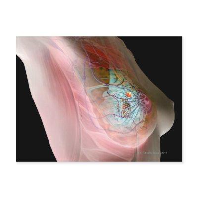 Breast Cancer Postcard
