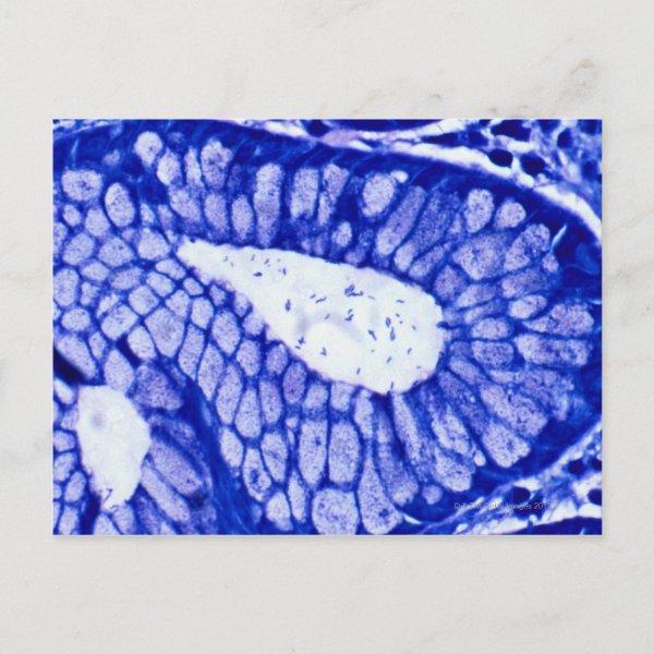 Helicobacter Pylori Postcard