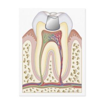 Illustration of Dental Filling Postcard