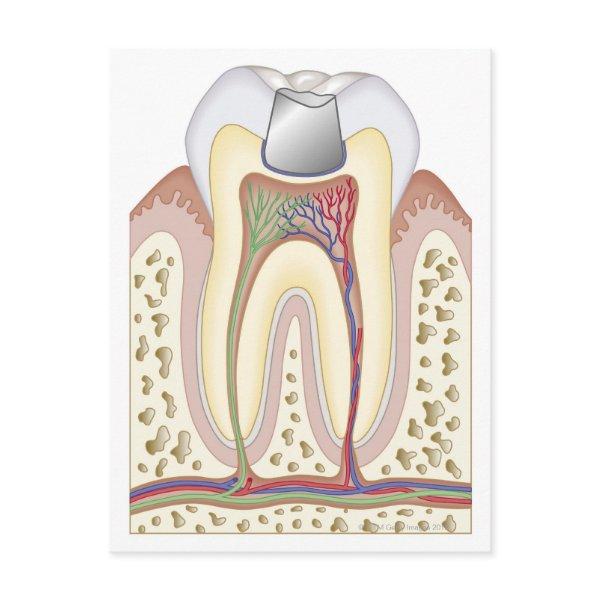 Illustration of Dental Filling Postcard