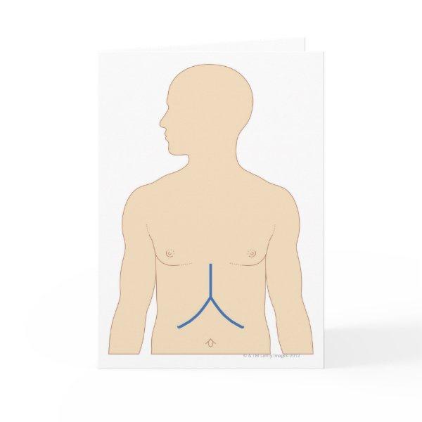Liver Transplant Card