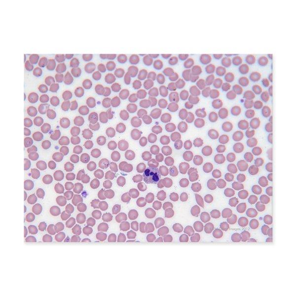 Malarial Blood Cells Postcard