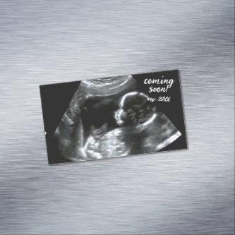 Pregnancy Announcement New Baby Scan Coming Soon   Magnet