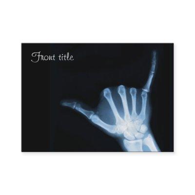 Shaka Sign X-Ray (Hang Loose)