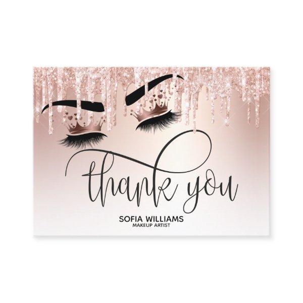 Wink Beautiful Brown Eye with Gold Crown Aftercare Referral Card