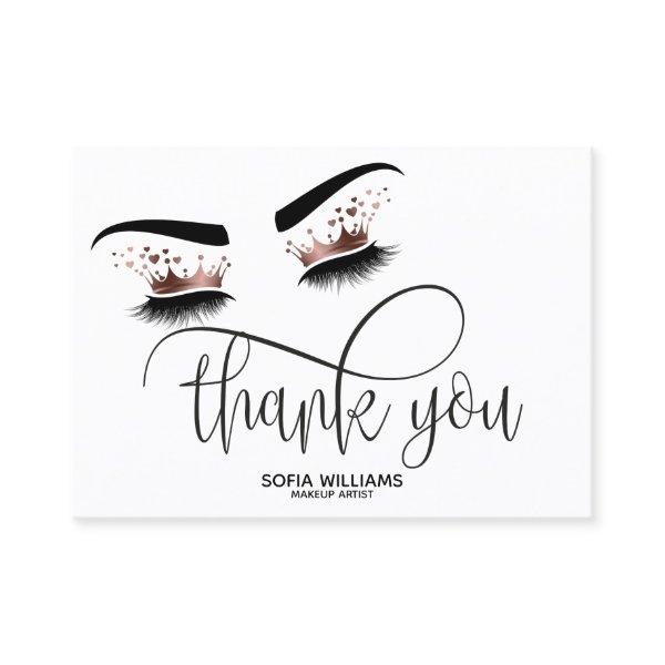 Wink Beautiful Brown Eye with Gold Crown Aftercare Referral Card