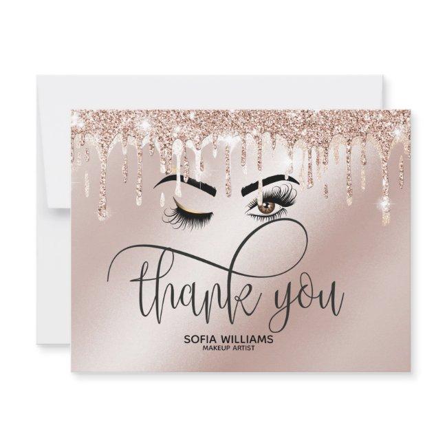 Wink Beautiful Brown Eye with Gold Crown Aftercare Thank You Card