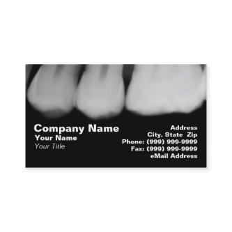 X-Rays of Teeth